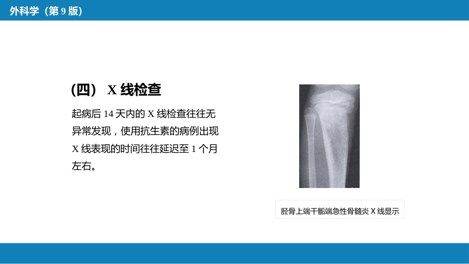 骨与关节化脓性感染_第9页