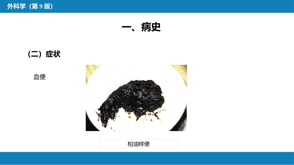 急腹症的诊断与鉴别诊断_第4页