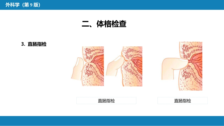 急腹症的诊断与鉴别诊断_第6页
