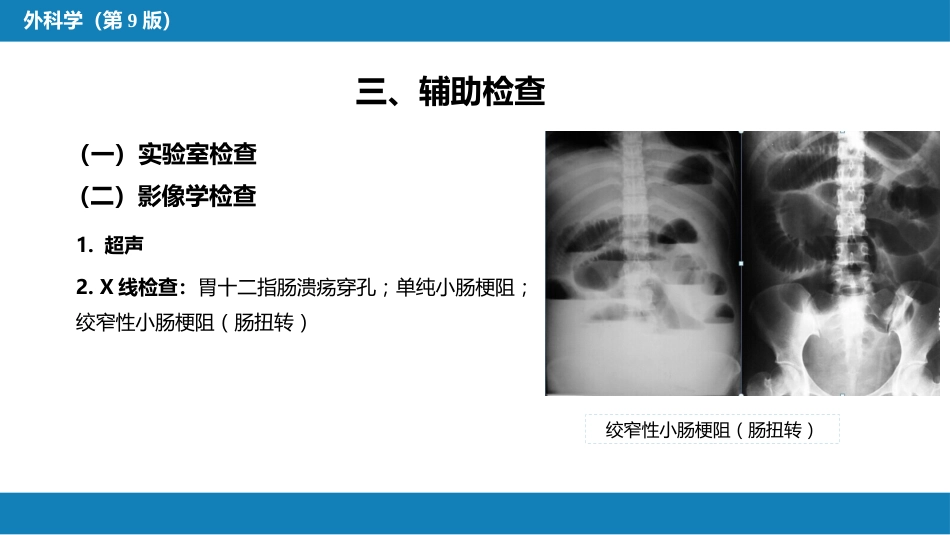 急腹症的诊断与鉴别诊断_第7页
