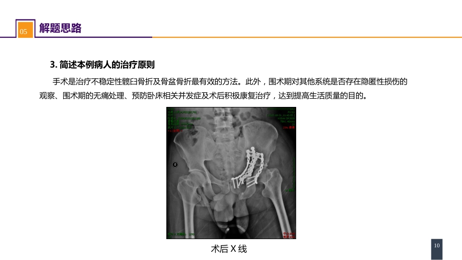 案例分析-髋臼骨折_第10页