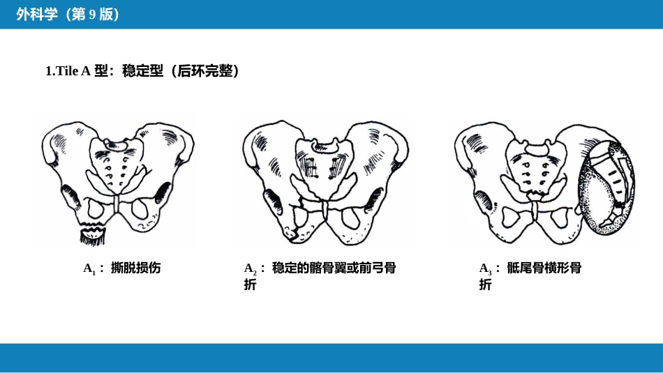 骨盆、髋臼骨折_第11页