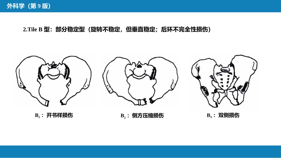 骨盆、髋臼骨折_第12页
