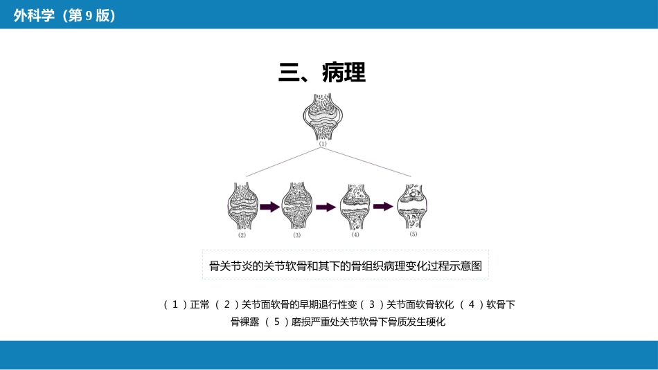 非化脓性关节炎_第7页