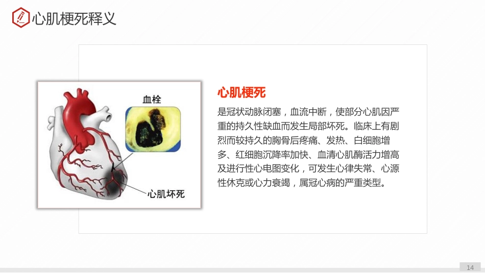 急性心肌梗死护理查房_第14页