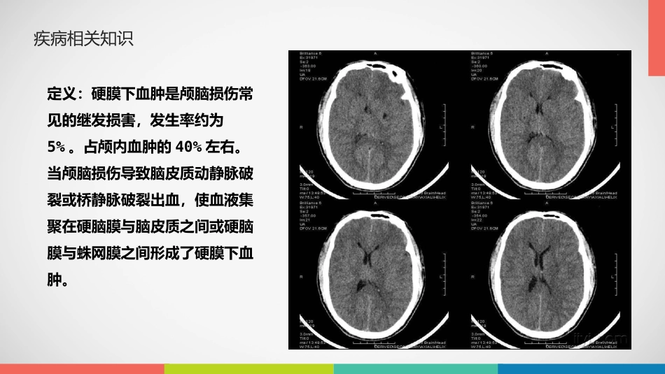 急性硬膜下血肿护理查房_第10页