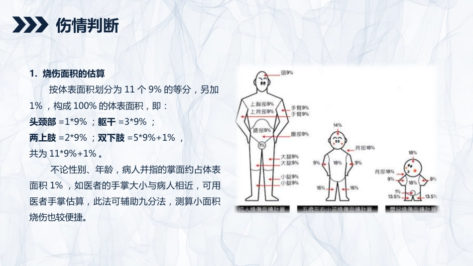 烧伤患者护理查房_第5页