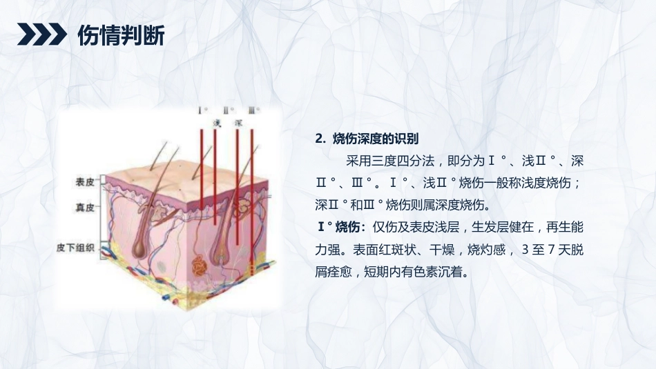 烧伤患者护理查房_第6页