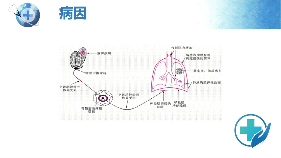 呼吸衰竭护理查房_第12页