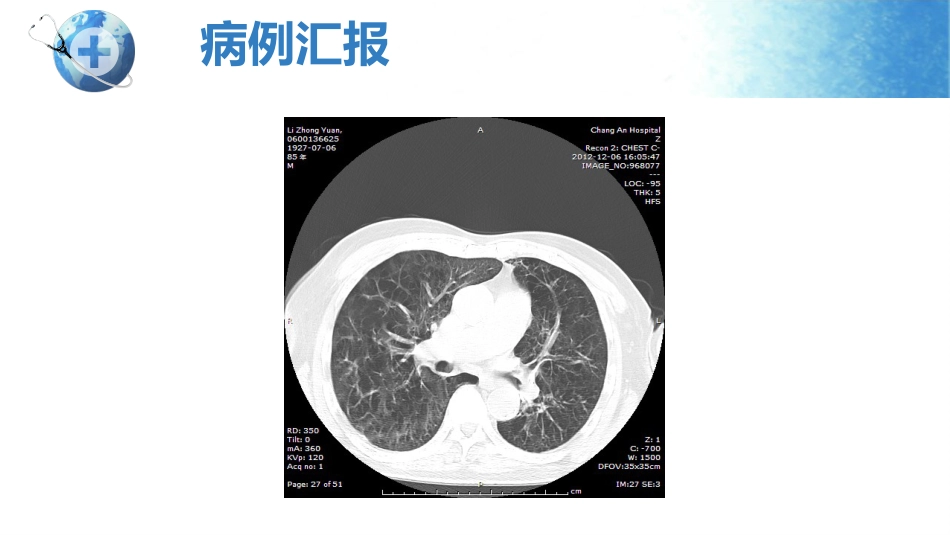 呼吸衰竭护理查房_第6页
