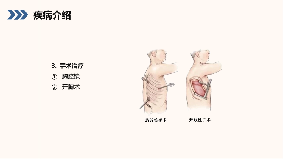 结核性胸膜炎患者护理查房_第13页