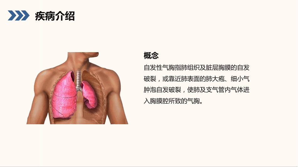 结核性胸膜炎患者护理查房_第4页