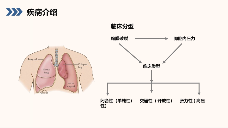 结核性胸膜炎患者护理查房_第6页