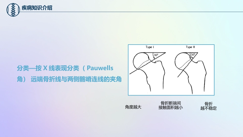 股骨颈骨折护理查房_第13页