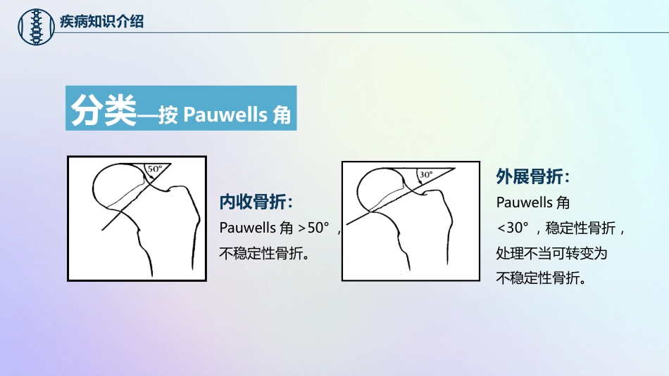 股骨颈骨折护理查房_第14页