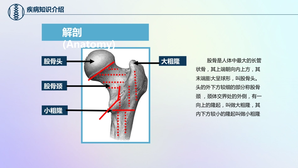 股骨颈骨折护理查房_第8页