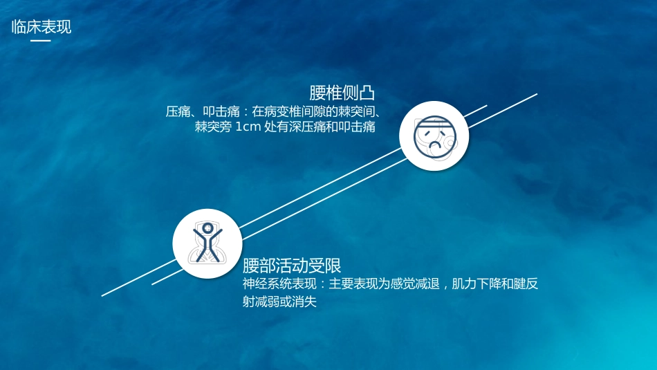 腰椎间盘突出护理查房_第10页