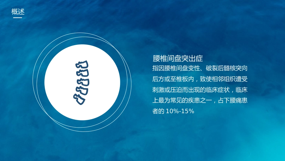 腰椎间盘突出护理查房_第4页