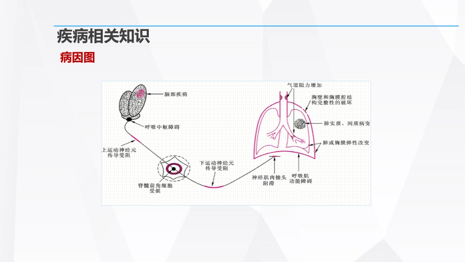 呼吸衰竭的护理查房_第11页