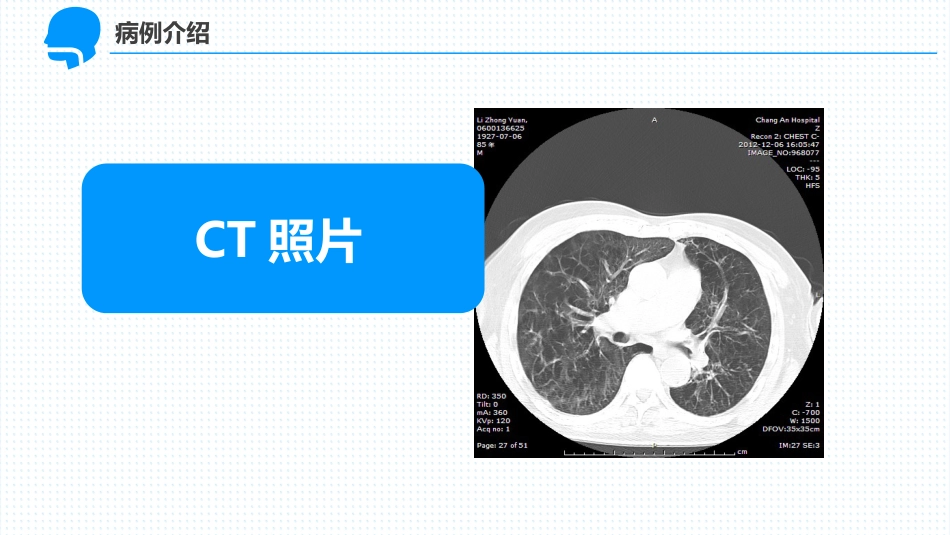呼吸衰竭护理_第6页