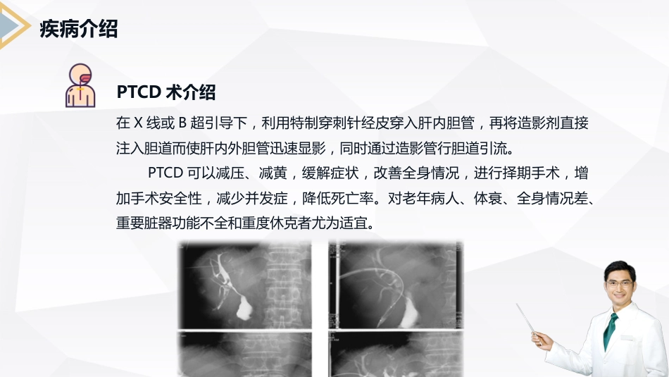  胰腺癌患者护理查房_第11页