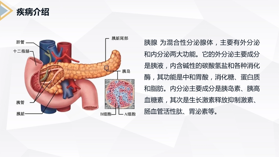  胰腺癌患者护理查房_第4页