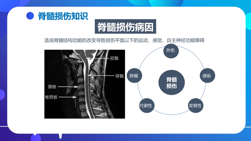 脊髓损伤的护理查房_第12页