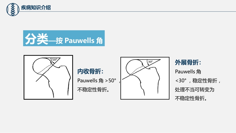 股骨颈骨折护理查房 (2)_第14页