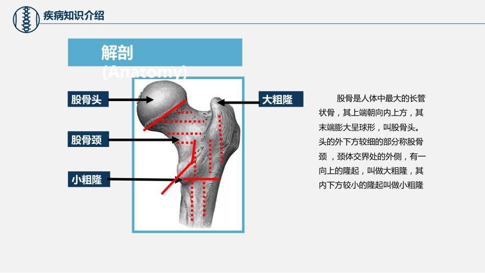 股骨颈骨折护理查房 (2)_第8页