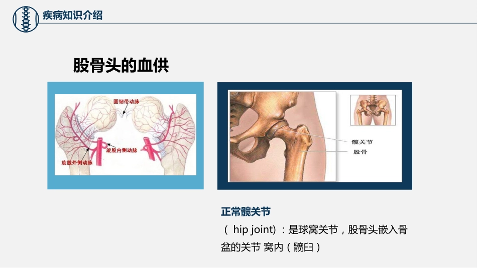 股骨颈骨折护理查房 (2)_第9页