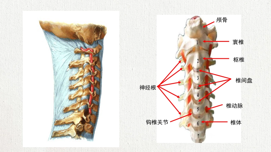 颈椎病护理查房 (2)_第2页
