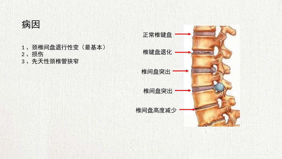 颈椎病护理查房 (2)_第6页