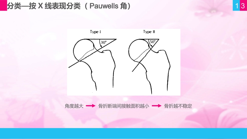 护理查房 (11)_第13页
