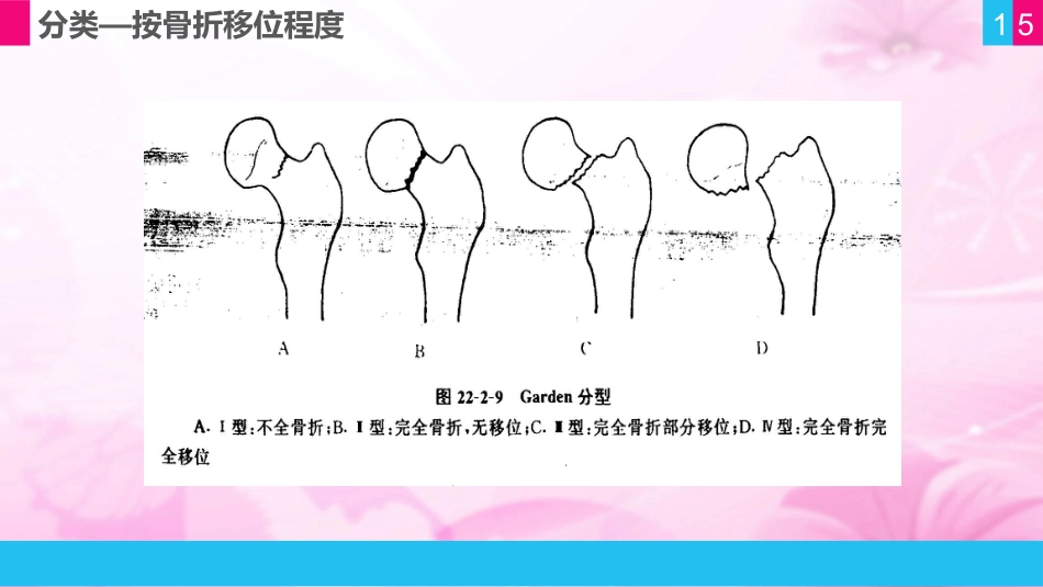 护理查房 (11)_第15页