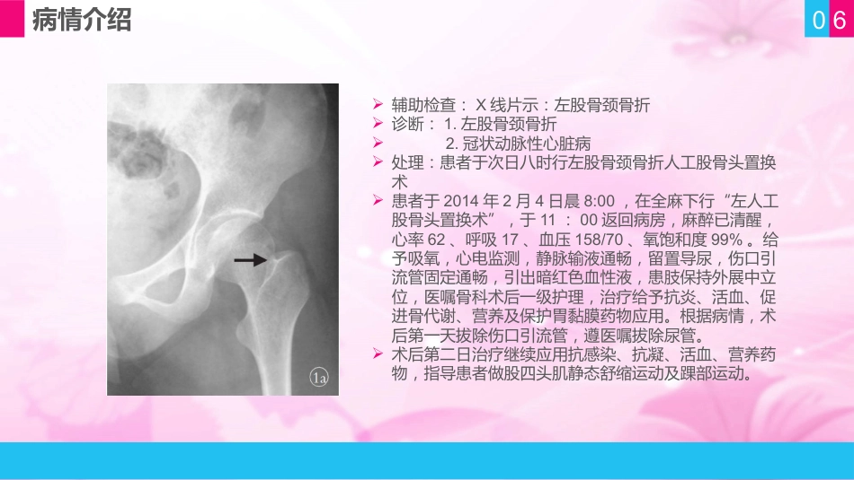 护理查房 (11)_第6页