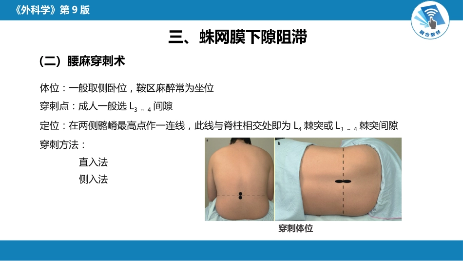 管椎内麻醉_第11页