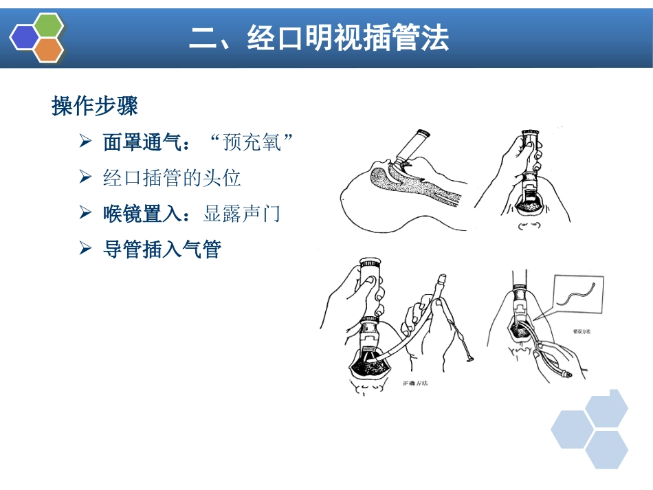 第4章 气管和支气管内插管_第14页