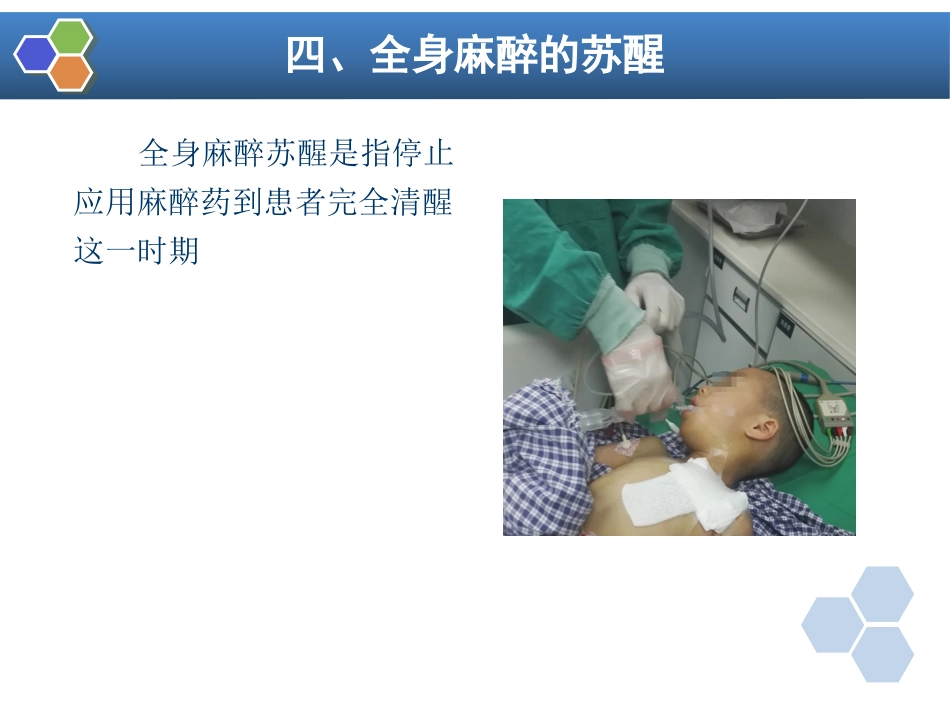 第5章 全身麻醉的基本概念_第12页