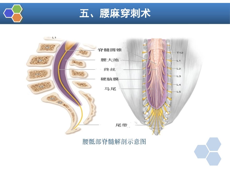 第10章 椎管内麻醉_第15页