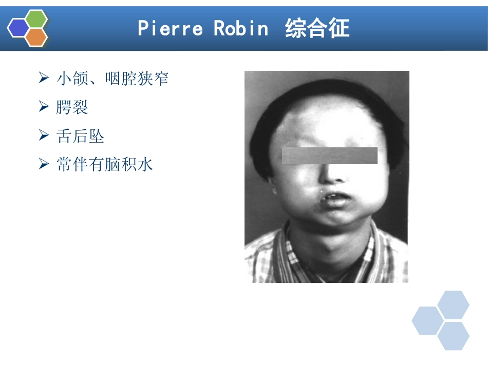 第22章 口腔颌面外科病人的麻醉_第12页