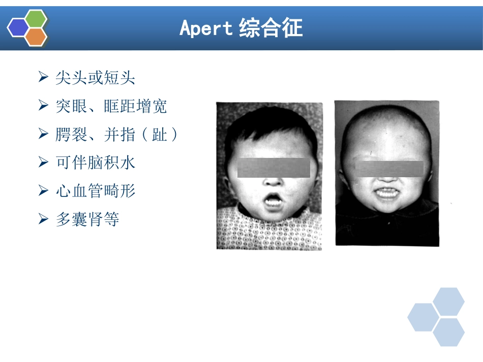 第22章 口腔颌面外科病人的麻醉_第14页