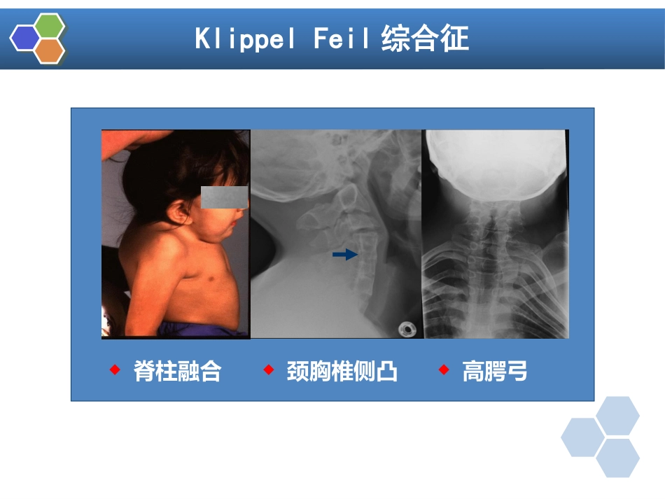 第22章 口腔颌面外科病人的麻醉_第15页
