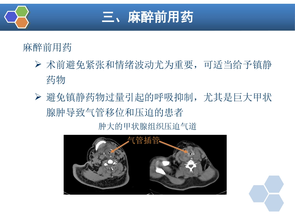第26章 内分泌病人手术的麻醉_第8页