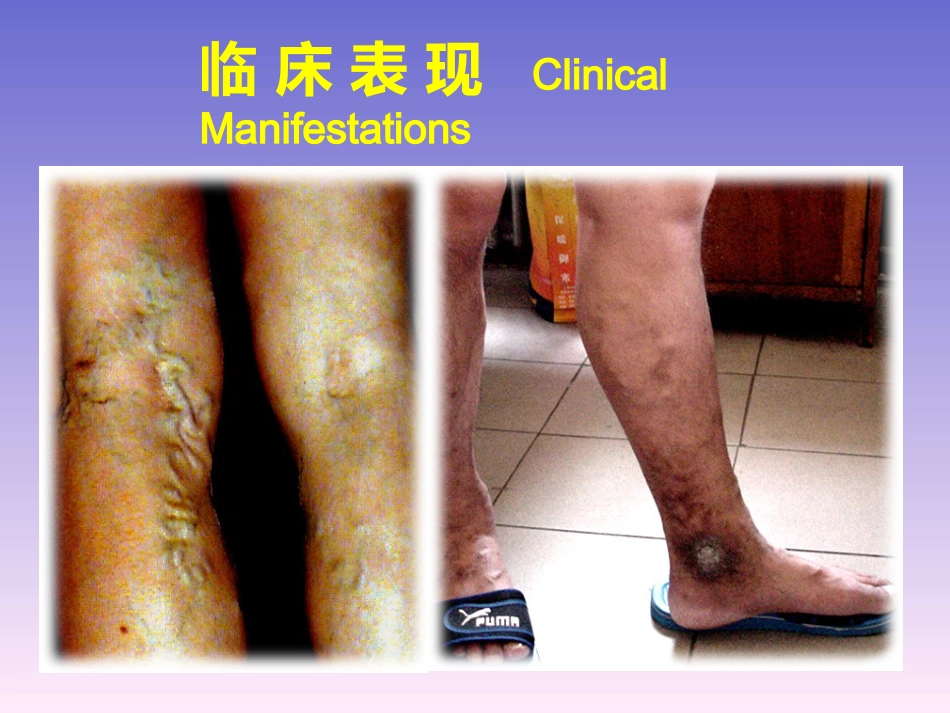 周围血管和疝_第10页
