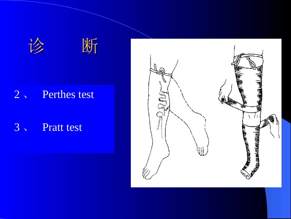 周围血管与淋巴管疾病test_第13页