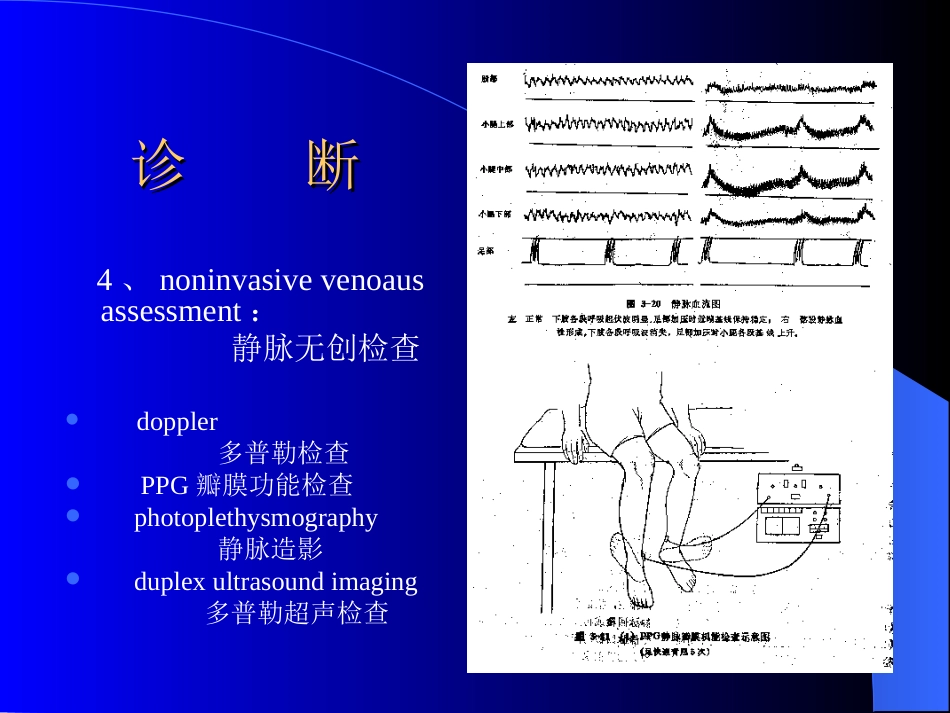周围血管与淋巴管疾病test_第14页