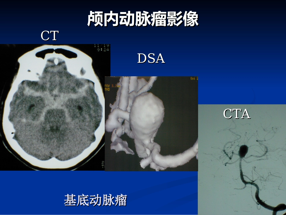 血管病-课时_第15页