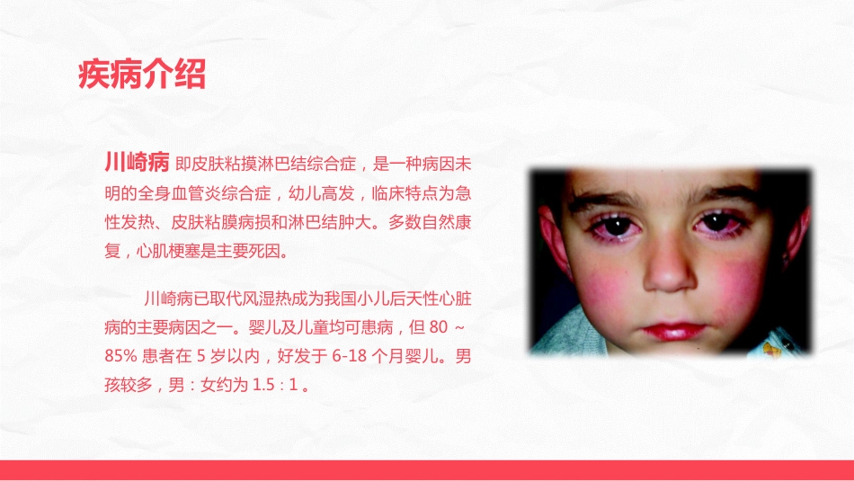 川崎病儿科护理进展_第4页
