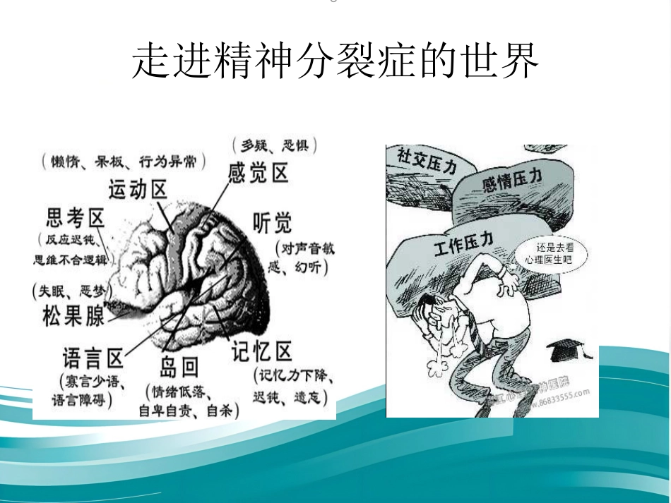 精神分裂症诊断及治疗进展_第4页