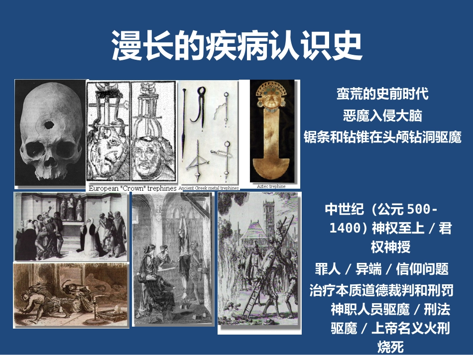精神分裂症的临床表现与治疗_第2页